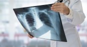 TB vaccine a potential new tool to fight COVID-19: Study