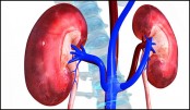 Healthy lifestyle choices for healthy kidney 