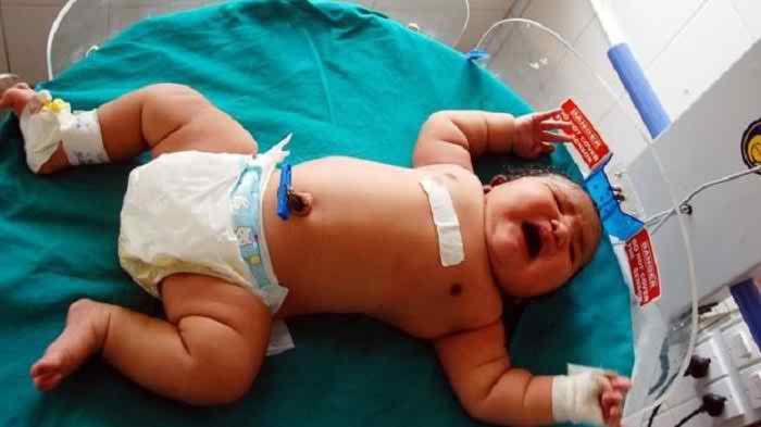 Mum gives birth to ‘heaviest baby’ in India