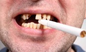 Smoking increase risk of tooth loss