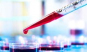 New blood test to boost cancer treatment