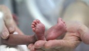 Premature birth leading cause of newborn deaths: Experts