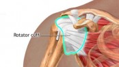 Shoulder pain may indicate higher heart disease risk: study