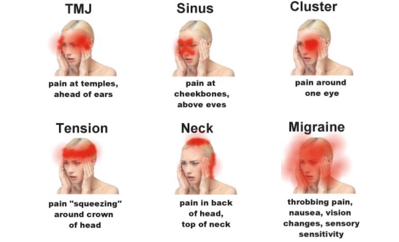 What Causes Headache On The Left Side Of The Eye