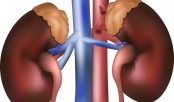 Australian researchers prevent progression of diabetic kidney disease 