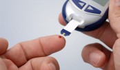 Diabetes’ link with Alzheimer’s disease identified